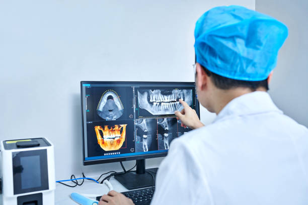 Best Emergency Treatment for Dental Infections or Abscesses in Ephrata, WA