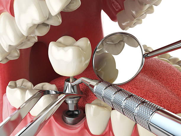 Best Emergency Gum Treatment in Ephrata, WA